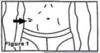 tukový kaliper - изображение 1